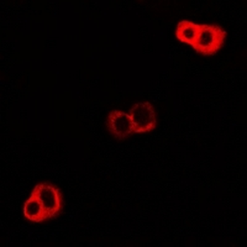 DNAJA3 Rabbit Polyclonal Antibody