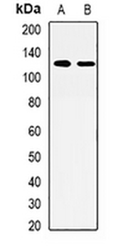 AP3-beta-1 Rabbit Polyclonal Antibody