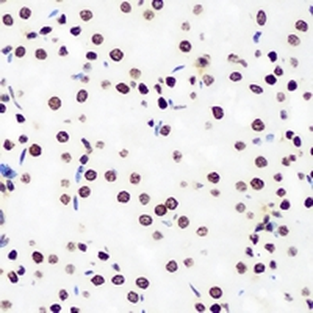 DDX41 Rabbit Polyclonal Antibody