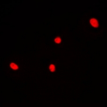 DDX41 Rabbit Polyclonal Antibody