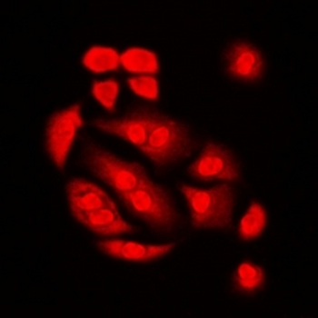 Int11 Rabbit Polyclonal Antibody