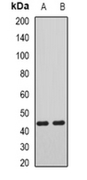 AIPL1 Rabbit Polyclonal Antibody