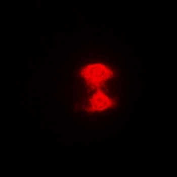 AIPL1 Rabbit Polyclonal Antibody