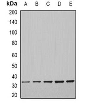 CFDP1 Rabbit Polyclonal Antibody