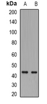 Toso Rabbit Polyclonal Antibody