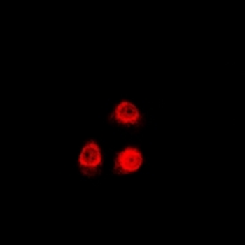 Uev1A Rabbit Polyclonal Antibody