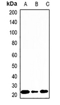 DCTD Rabbit Polyclonal Antibody