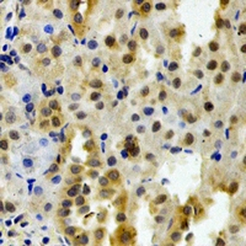 DCTD Rabbit Polyclonal Antibody