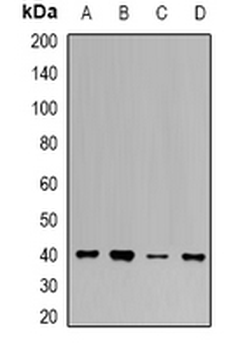 UROD Rabbit Polyclonal Antibody