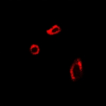 UROD Rabbit Polyclonal Antibody