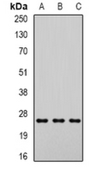 DCXR Rabbit Polyclonal Antibody