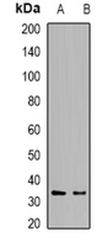 DCK Rabbit Polyclonal Antibody