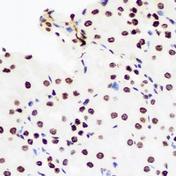 DCK Rabbit Polyclonal Antibody