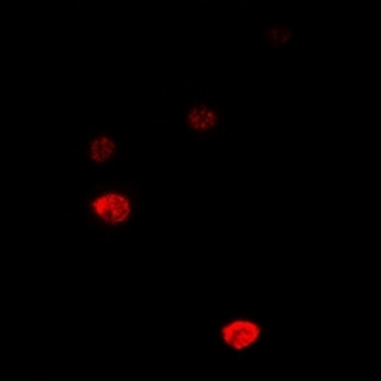 DCK Rabbit Polyclonal Antibody