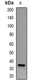 CD158i Rabbit Polyclonal Antibody