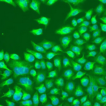 CD158i Rabbit Polyclonal Antibody