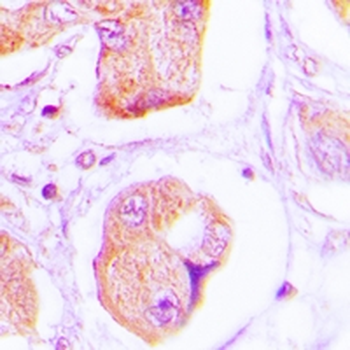OLFM1 Rabbit Polyclonal Antibody
