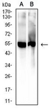 5-hydroxyuridine Mouse Monoclonal Antibody