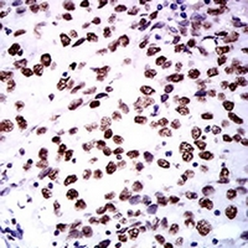 ZFP91 Mouse Monoclonal Antibody