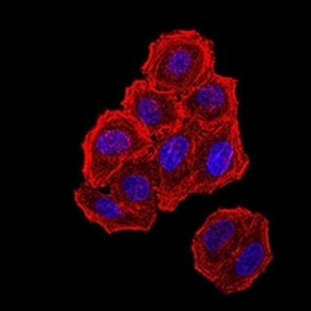 ZFP91 Mouse Monoclonal Antibody