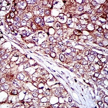 REX-1 Mouse Monoclonal Antibody