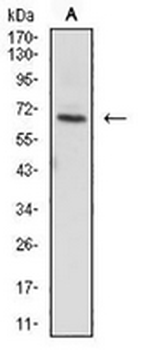 ZAP70 Mouse Monoclonal Antibody