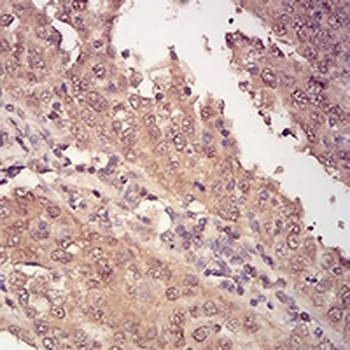 14-3-3 beta Mouse Monoclonal Antibody