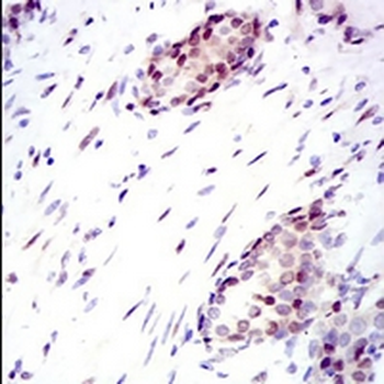 YAP1 Mouse Monoclonal Antibody