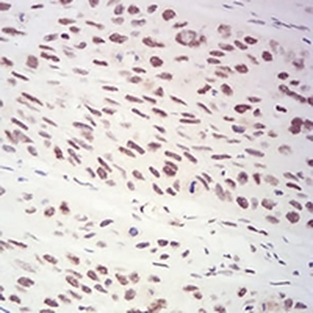 XRN2 Mouse Monoclonal Antibody