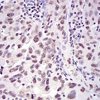 Ku70 Mouse Monoclonal Antibody