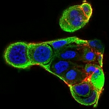 Ku70 Mouse Monoclonal Antibody