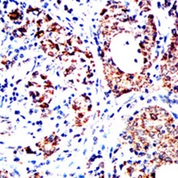 XPC Mouse Monoclonal Antibody