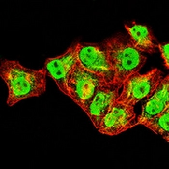 XPC Mouse Monoclonal Antibody