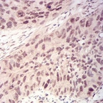 WTAP Mouse Monoclonal Antibody