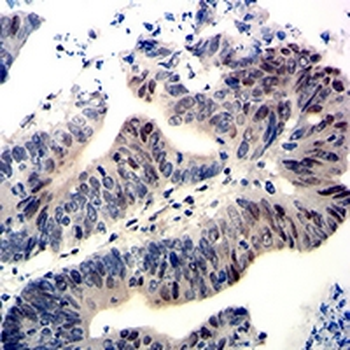 Wilms Tumor 1 Mouse Monoclonal Antibody