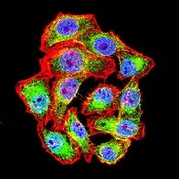 Wilms Tumor 1 Mouse Monoclonal Antibody