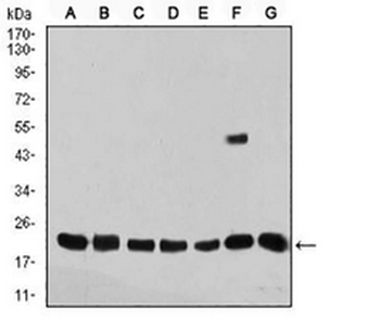 Selenoprotein S Mouse Monoclonal Antibody