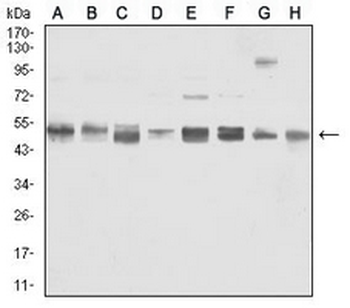 Vimentin Mouse Monoclonal Antibody