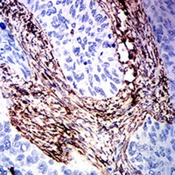 Vimentin Mouse Monoclonal Antibody