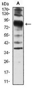 Villin Mouse Monoclonal Antibody