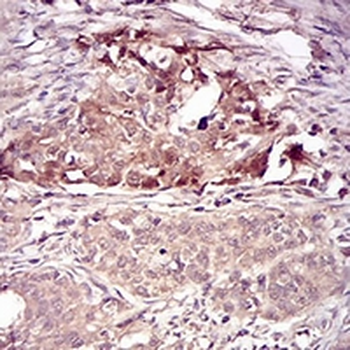 Villin Mouse Monoclonal Antibody