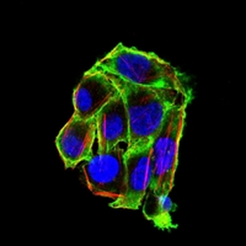 Villin Mouse Monoclonal Antibody