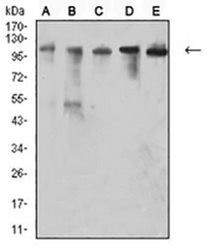 CD106 Mouse Monoclonal Antibody