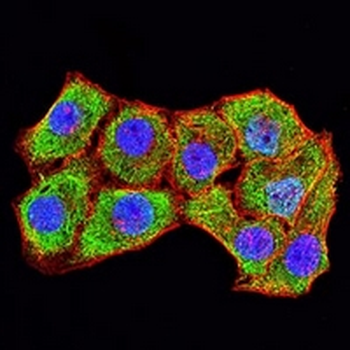 CD106 Mouse Monoclonal Antibody