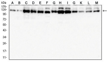 USP7 Mouse Monoclonal Antibody