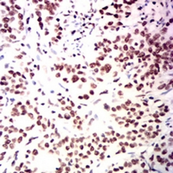 USP7 Mouse Monoclonal Antibody
