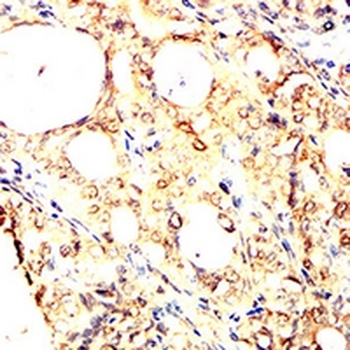 ULK3 Mouse Monoclonal Antibody