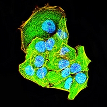 ULK3 Mouse Monoclonal Antibody