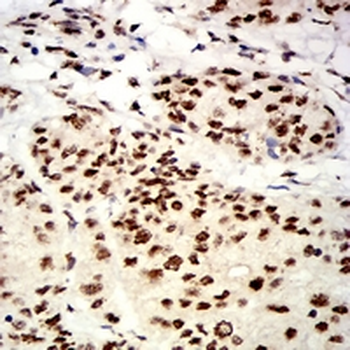 UHRF1 Mouse Monoclonal Antibody