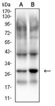 PGP9.5 Mouse Monoclonal Antibody